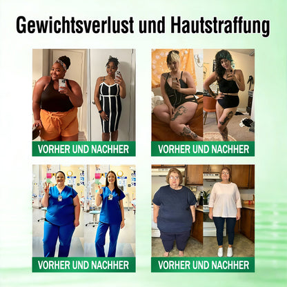 🧑‍⚕️ 𝐎𝐟𝐟𝐢𝐜𝐢𝐚𝐥𝐞𝐫 𝐃𝐞𝐮𝐭𝐬𝐜𝐡𝐥𝐚𝐧𝐝-𝐒𝐡𝐨𝐩 | 🇩🇪 𝐂𝐚𝐫𝐞𝐔𝐩𝐥𝐢𝐟𝐭® Moringa · Berberin × NAD+ 𝟏𝟎-𝐢𝐧-𝟏 𝐀𝐝𝐯𝐚𝐧𝐜𝐞𝐝 𝐍𝐚𝐧𝐨-𝐌𝐢𝐤𝐫𝐨𝐧𝐚𝐝𝐞𝐥-𝐏𝐚𝐭𝐜𝐡 — 𝐄𝐢𝐧𝐦𝐚𝐥 𝐭ä𝐠𝐥𝐢𝐜𝐡, 𝐬𝐢𝐜𝐡𝐭𝐛𝐚𝐫𝐞 𝐄𝐫𝐠𝐞𝐛𝐧𝐢𝐬𝐬𝐞 𝐢𝐧 𝟕 𝐓𝐚𝐠𝐞𝐧