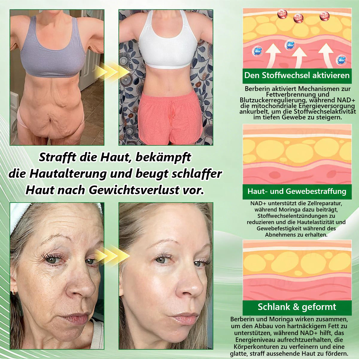 🇩🇪 𝐎𝐟𝐟𝐢𝐜𝐢𝐚𝐥𝐞𝐫 𝐃𝐞𝐮𝐭𝐬𝐜𝐡𝐥𝐚𝐧𝐝-𝐒𝐡𝐨𝐩 | 🧑‍⚕️🩺 𝐂𝐚𝐫𝐞𝐔𝐩𝐥𝐢𝐟𝐭® Moringa · Berberin × NAD+ 𝟏𝟎-𝐢𝐧-𝟏 𝐀𝐝𝐯𝐚𝐧𝐜𝐞𝐝 𝐍𝐚𝐧𝐨-𝐌𝐢𝐤𝐫𝐨𝐧𝐚𝐝𝐞𝐥-𝐏𝐚𝐭𝐜𝐡 — 𝐄𝐢𝐧𝐦𝐚𝐥 𝐭ä𝐠𝐥𝐢𝐜𝐡, 𝐬𝐢𝐜𝐡𝐭𝐛𝐚𝐫𝐞 𝐄𝐫𝐠𝐞𝐛𝐧𝐢𝐬𝐬𝐞 𝐢𝐧 𝟕 𝐓𝐚𝐠𝐞𝐧